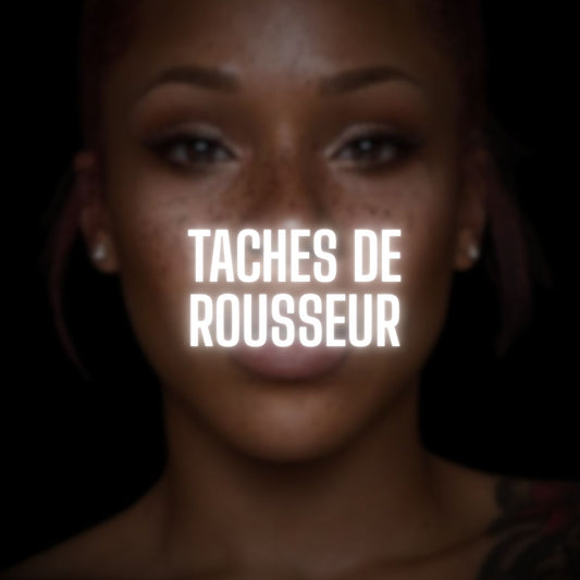Tache de rousseurs